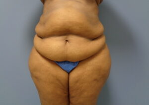 Before & After Pictures in Nashville, TN