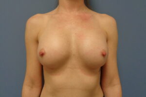 Before & After Pictures in Nashville, TN