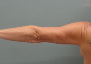 Before & After Pictures in Nashville, TN