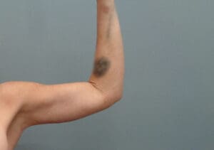 Before & After Pictures in Nashville, TN