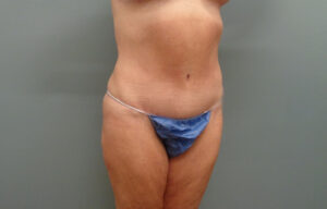 Before & After Pictures in Nashville, TN