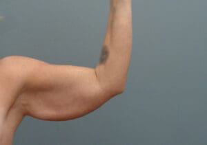 Before & After Pictures in Nashville, TN