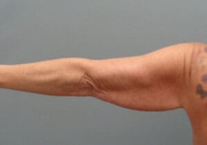 Before & After Pictures in Nashville, TN