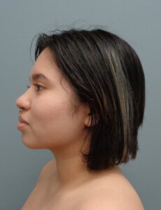 Before & After Pictures in Nashville, TN