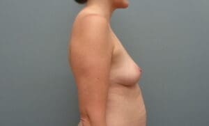 Before & After Pictures in Nashville, TN