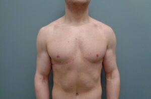 Before & After Pictures in Nashville, TN
