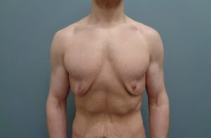 Before & After Pictures in Nashville, TN