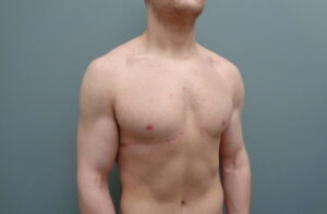 Before & After Pictures in Nashville, TN
