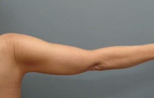 Before & After Pictures in Nashville, TN