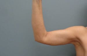 Before & After Pictures in Nashville, TN