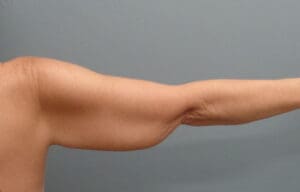 Before & After Pictures in Nashville, TN