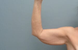 Before & After Pictures in Nashville, TN