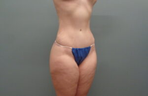 Before & After Pictures in Nashville, TN