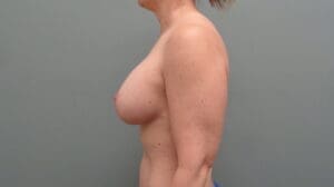 Before & After Pictures in Nashville, TN