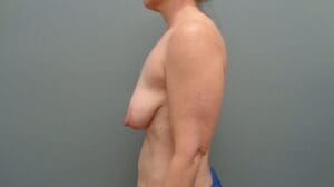 Before & After Pictures in Nashville, TN