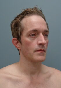 Before & After Pictures in Nashville, TN