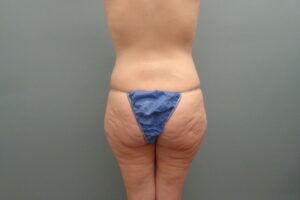 Before & After Pictures in Nashville, TN
