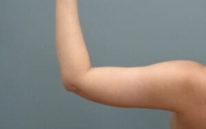 Before & After Pictures in Nashville, TN