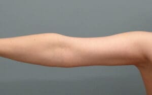 Before & After Pictures in Nashville, TN