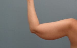 Before & After Pictures in Nashville, TN