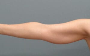 Before & After Pictures in Nashville, TN