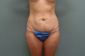Before & After Pictures in Nashville, TN