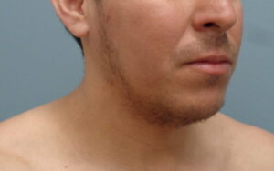 Before & After Pictures in Nashville, TN