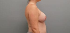 Before & After Pictures in Nashville, TN