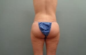 Before & After Pictures in Nashville, TN