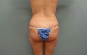 Before & After Pictures in Nashville, TN