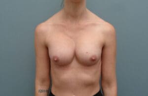 Before & After Pictures in Nashville, TN