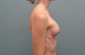 Before & After Pictures in Nashville, TN