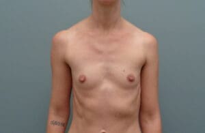 Before & After Pictures in Nashville, TN