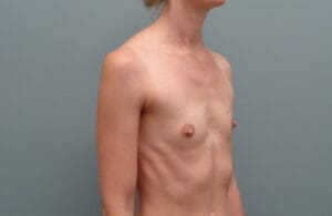 Before & After Pictures in Nashville, TN