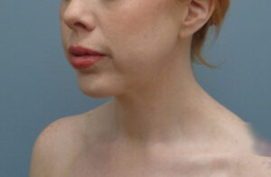 Before & After Pictures in Nashville, TN