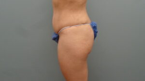 Before & After Pictures in Nashville, TN