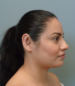 Before & After Pictures in Nashville, TN
