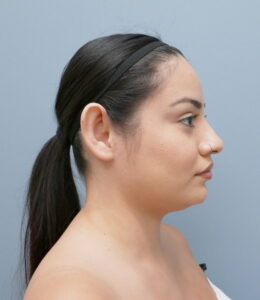 Before & After Pictures in Nashville, TN