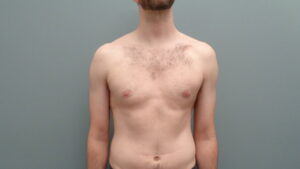 Before & After Pictures in Nashville, TN