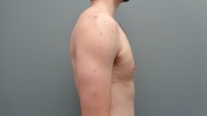 Before & After Pictures in Nashville, TN