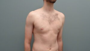 Before & After Pictures in Nashville, TN