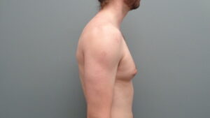 Before & After Pictures in Nashville, TN
