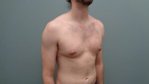 Before & After Pictures in Nashville, TN