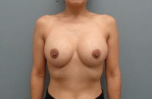 Before & After Pictures in Nashville, TN