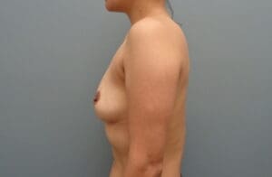 Before & After Pictures in Nashville, TN