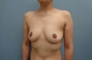 Before & After Pictures in Nashville, TN