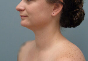 Before & After Pictures in Nashville, TN