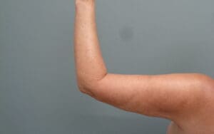 Before & After Pictures in Nashville, TN