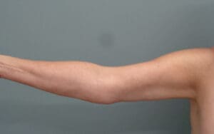 Before & After Pictures in Nashville, TN