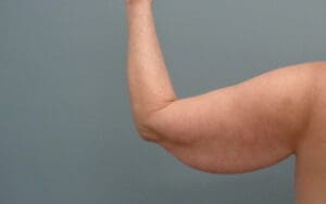 Before & After Pictures in Nashville, TN